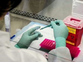 CDC scientist prepares biopsy sample for molecular testing in laboratory